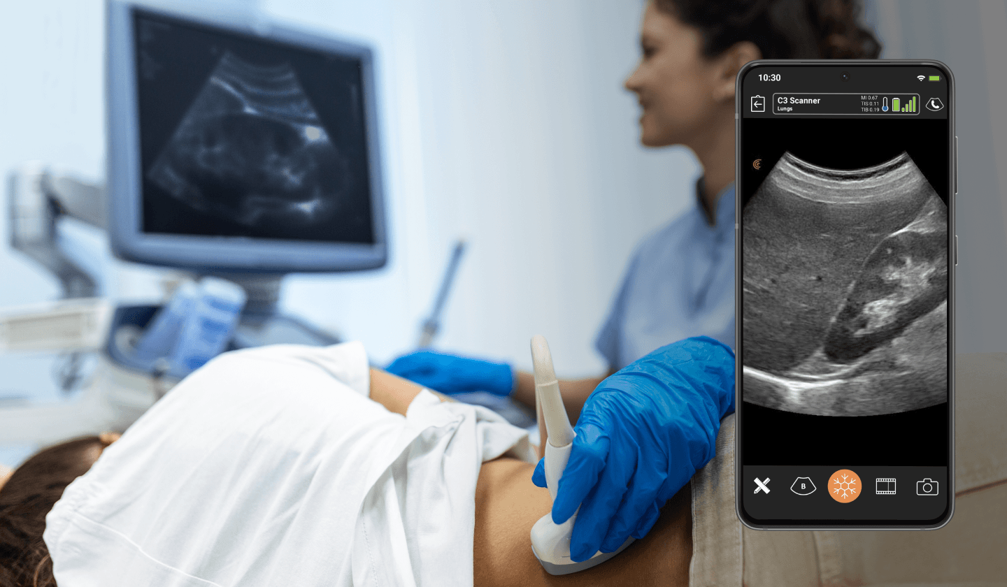 Cardiac ultrasound app background diagnostics