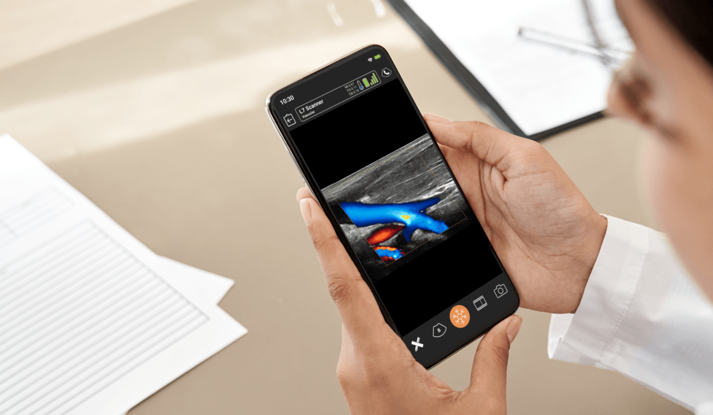 Cardiac Ultrasound App